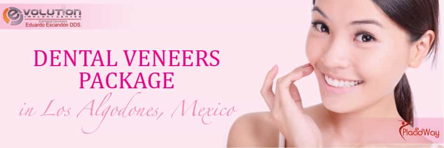 Dental Veneers Package in Los Algodones, Mexico